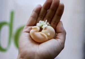 Vänstervriden media bidrar till slarvig snedvriden abortdebatt