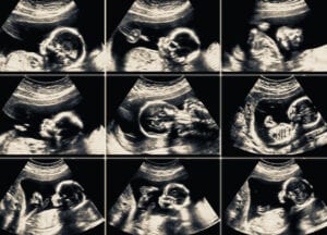 Kommentarer till Expressens reportage om abort - DEL 3 - Anmärkningsvärda påståenden från en professor