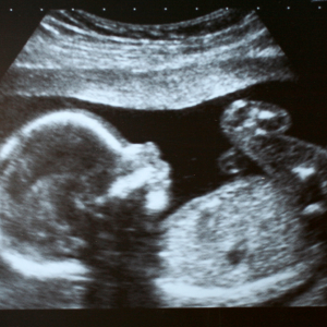 WHO under abortaktivisters inflytande